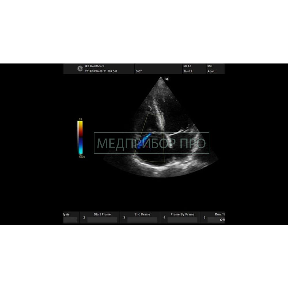 GE Healthcare Versana Active - ультразвуковая система