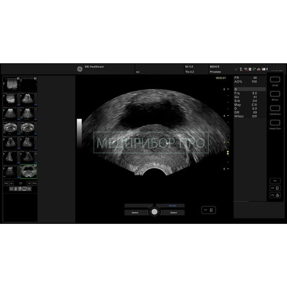 GE Healthcare Versana Premier Black - ультразвуковая система