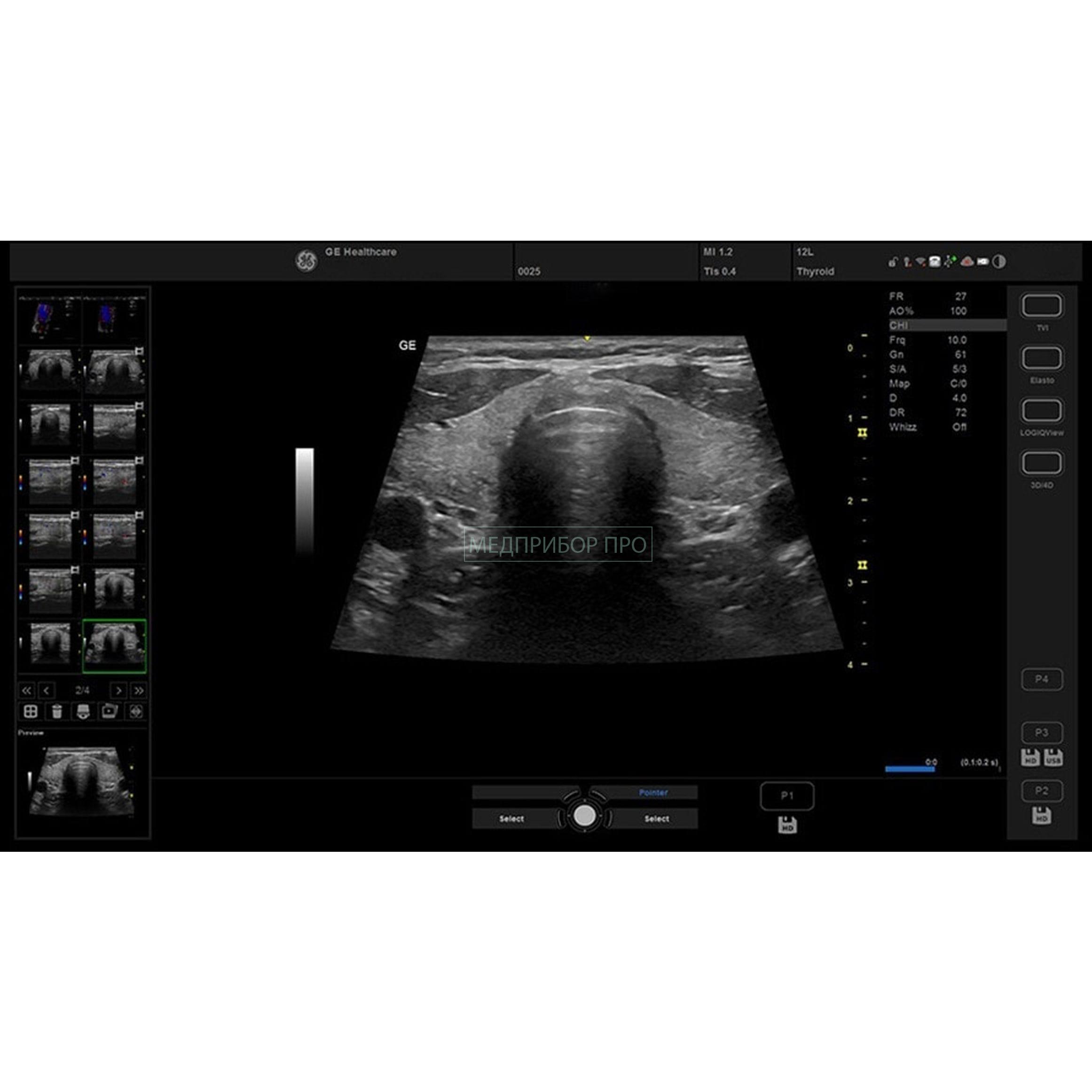 GE Healthcare Versana Premier Black - ультразвуковая система