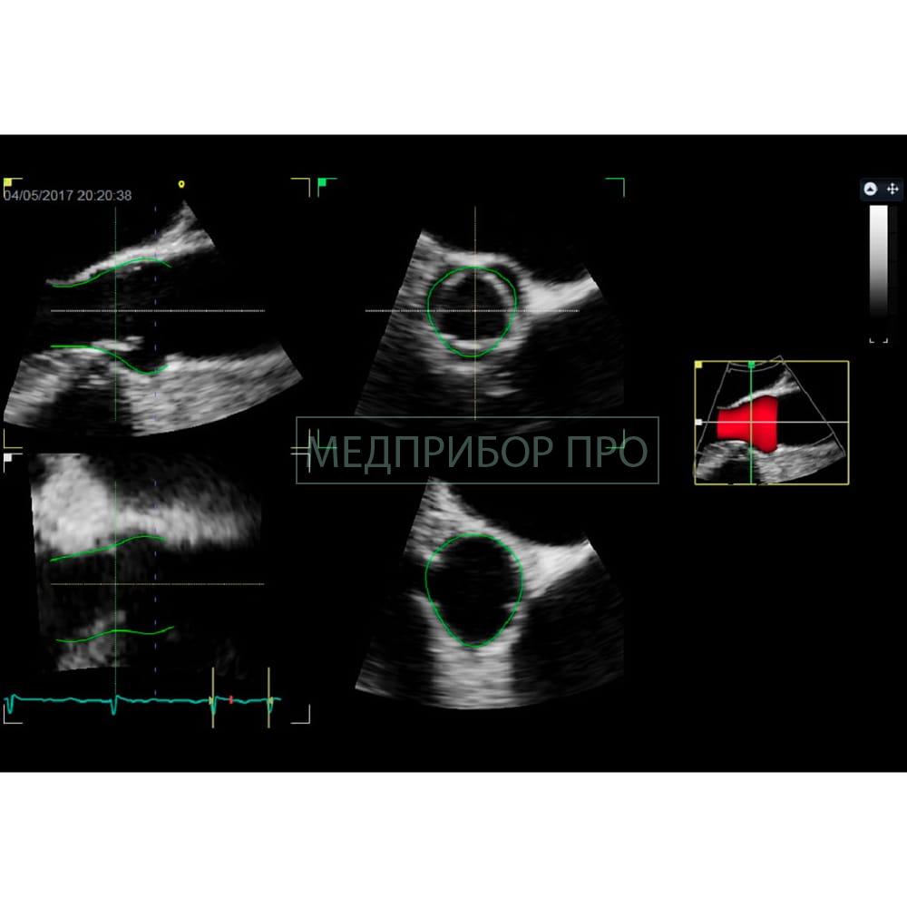GE Healthcare Vivid E95 - ультразвуковая система