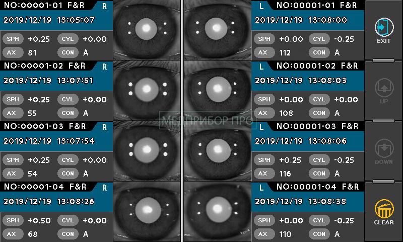Potec PRK-8000 - авторефкератометр Potec PRK-8000 - авторефкератометр